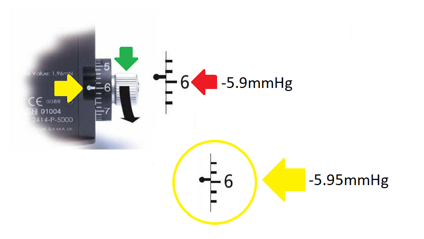 calibration_error_checking_-5.9mmhg